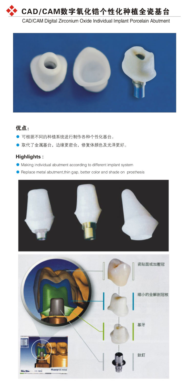 CAD/CAM数字氧化锆个性化画图全瓷基台cad的卡卡种植一图片